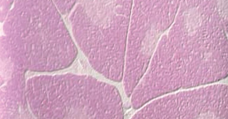 Close up of pink tissue 