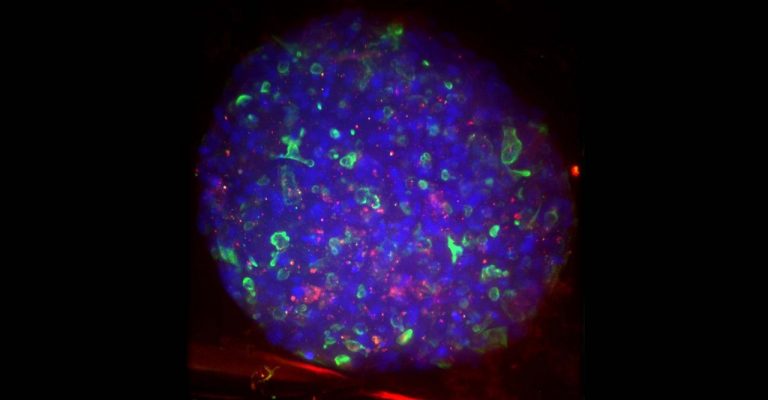 Liver Cell Image