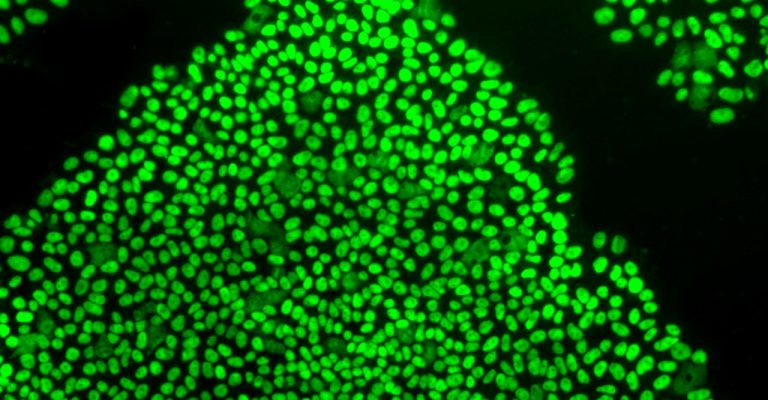Fluorescence-Based Tumor Cell Invasion Assay