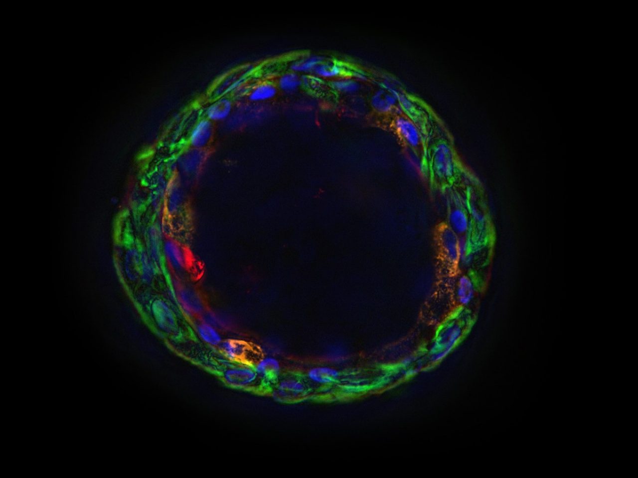 A spherical cell with a hollow center on a black background