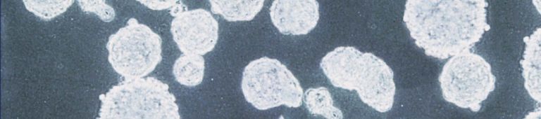 Ultra Low Attachment Surface Enable 3d Spheroid Formation Corning Amazon's choice for corning plates. ultra low attachment surface enable