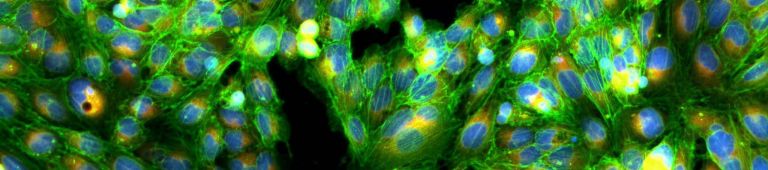 High Content Screening Hcs Applications Microplates For High Content Screening And Analysis Corning