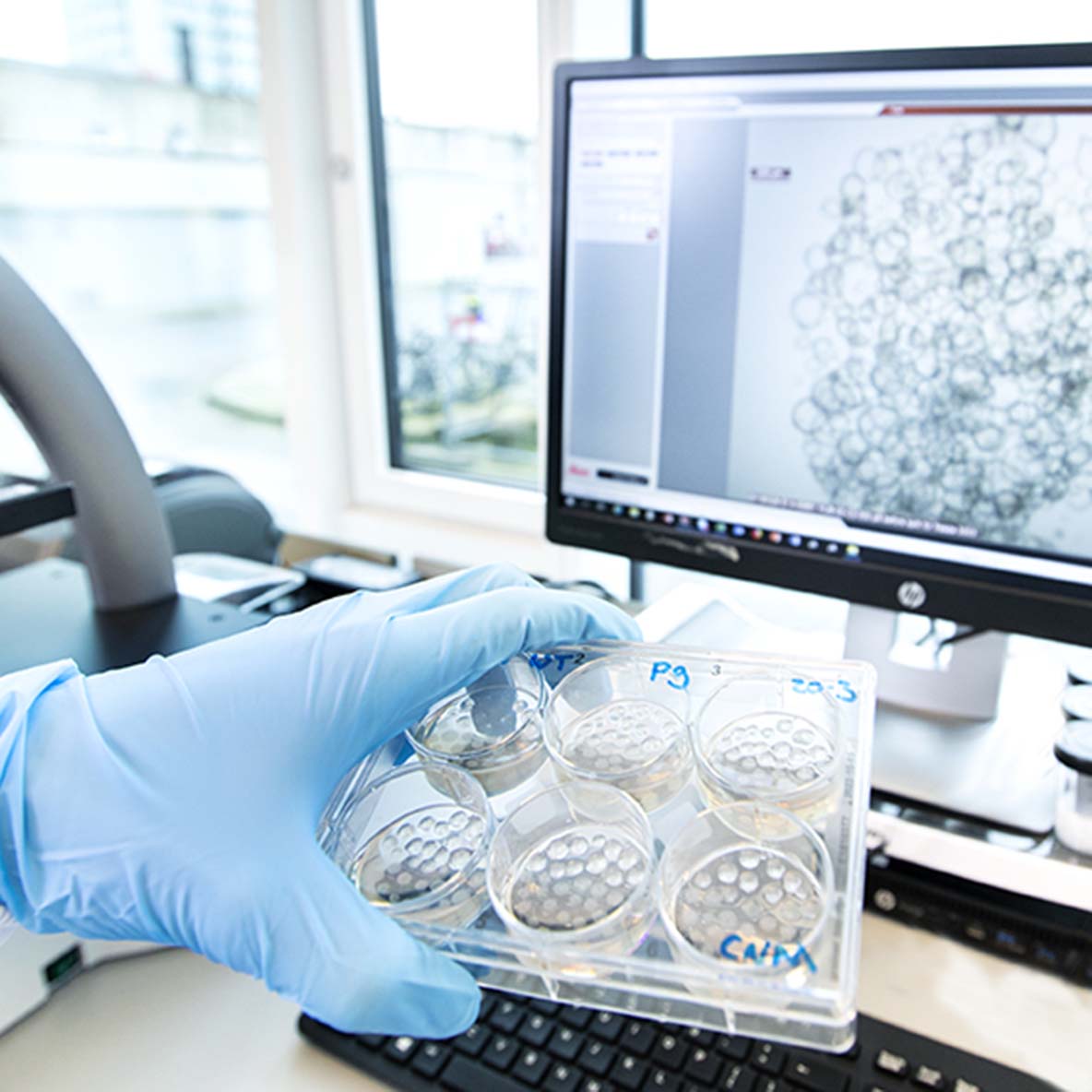 がんの個別化治療進展の鍵を握るhubオルガノイド Hubオルガノイド技術 Corning がんの個別化治療進展の鍵を握るhubオルガノイド Hubオルガノイド技術 Corning