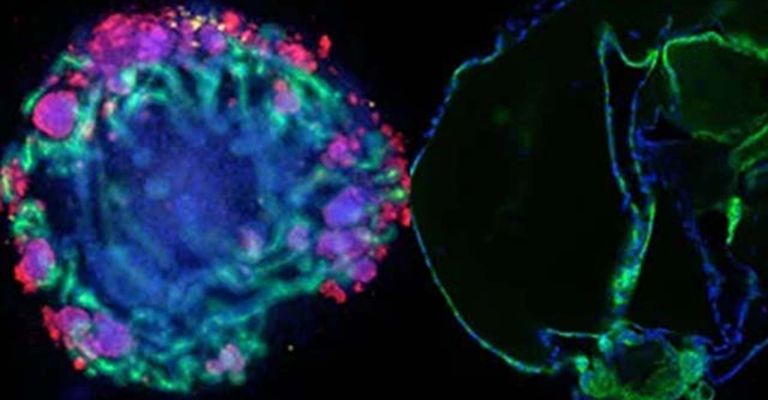Brain Organoids & Their Application in Disease Modeling