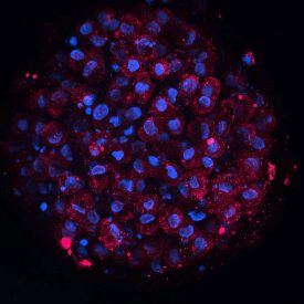 Blue and Red Organoid
