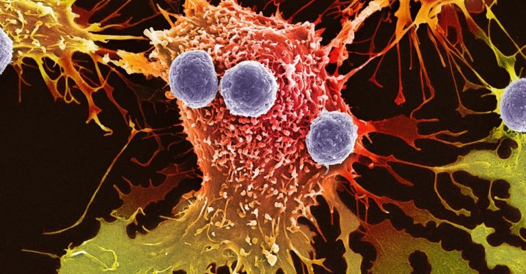 Cell Therapy Production: A Comprehensive Look at Key Elements to Success