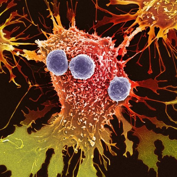 Adherent vs. Suspension Infographic