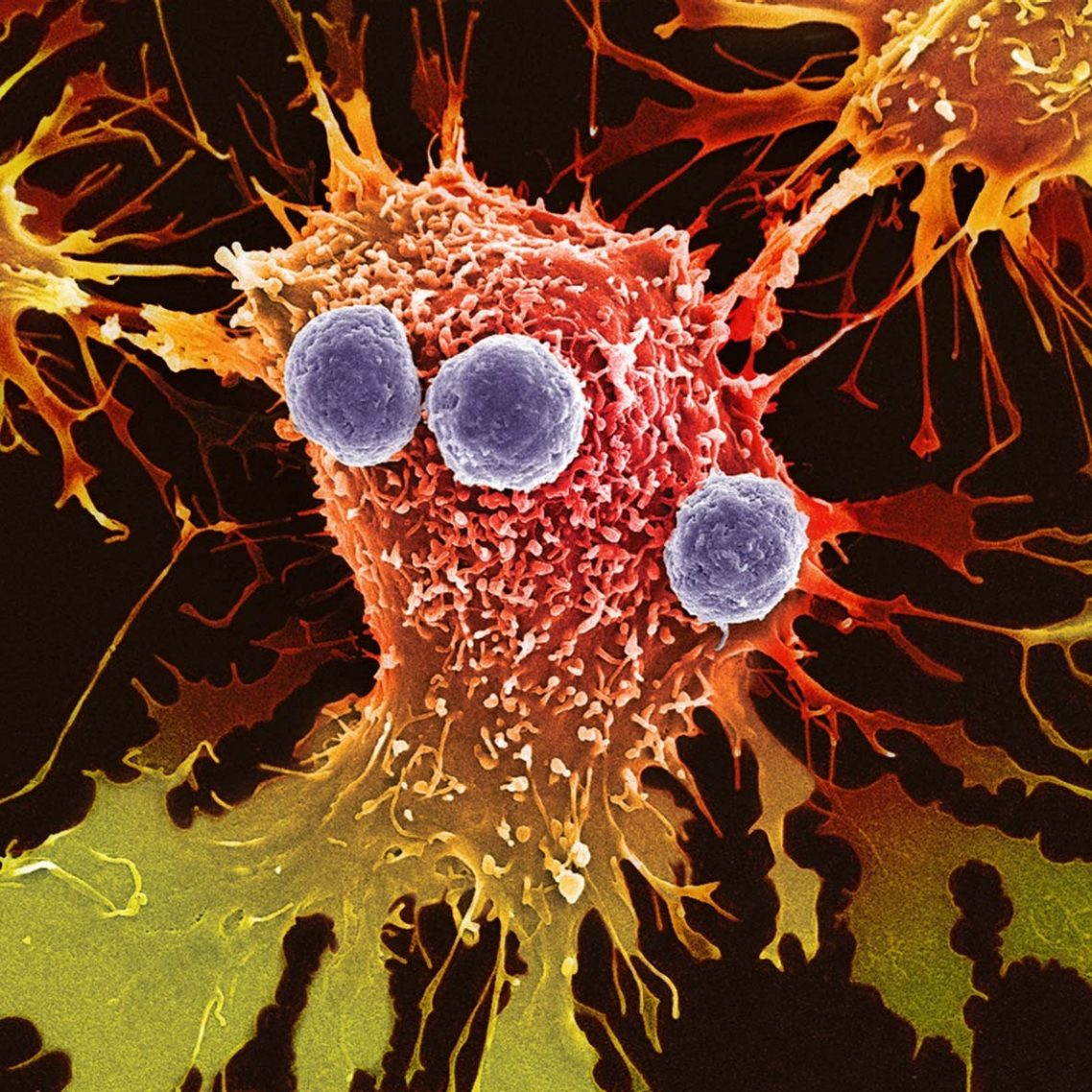 Adherent vs. Suspension Infographic