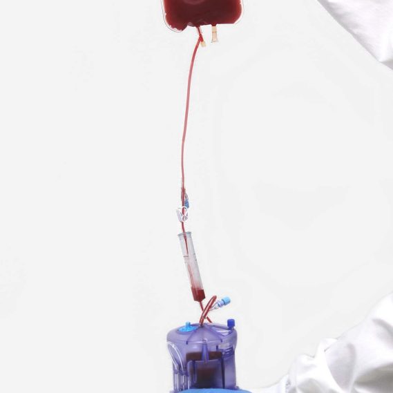 XLAB System Mononuclear Cell Isolation Corning