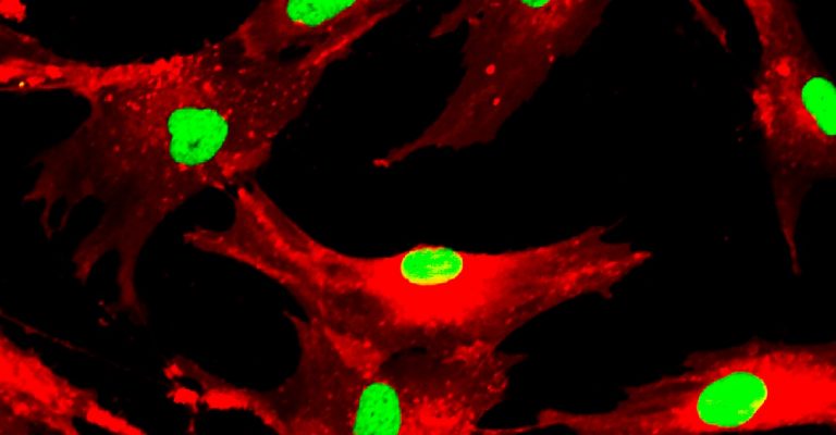 Mesenchymal stem cells