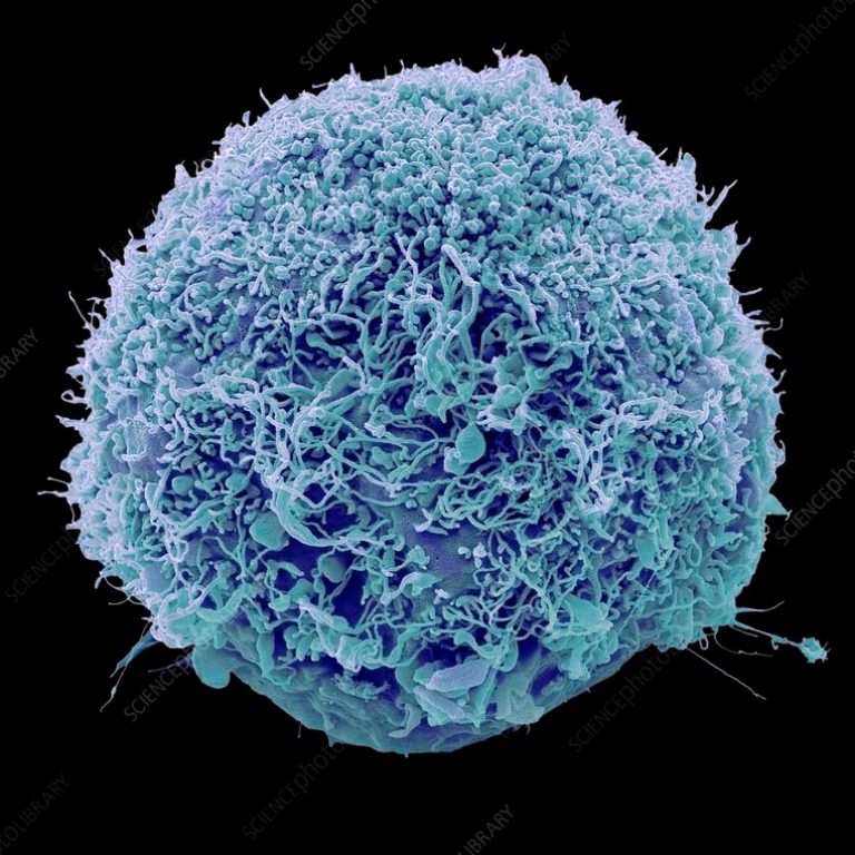 Mesenchymal stem cells (MSCs)