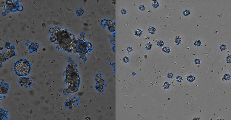 Organoid Counting Software