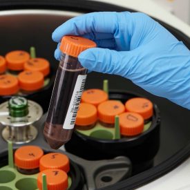 A lab technician uses Corning® centrifuge tubes to process patient samples.