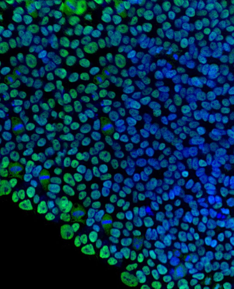 Matrigel Matrix | Extracellular Matrix | Corning