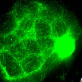 オルガノイドの内部で増殖する神経膠腫腫瘍細胞。Corning® Matrigel®基底膜マトリックスは、オルガノイド開発のあらゆる段階に不可欠なものです。画像はAmanda Linkous博士提供。