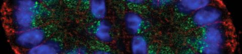 Corning® Matrigel® Matrix