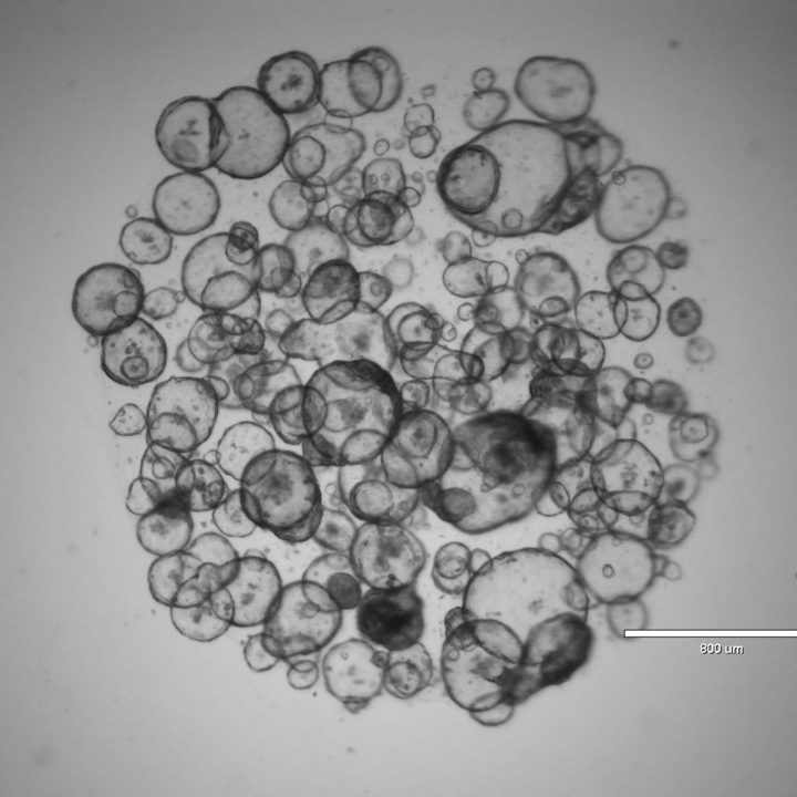 3D Cell Culture Primer Freezing, Culturing, and Measuring Organoids