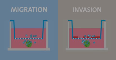 Cell Migration and Invasion with Transwell Permeable Supports