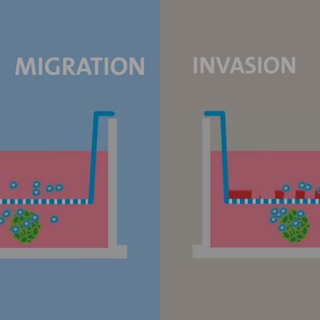 Cell Migration and Invasion with Transwell Permeable Supports