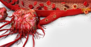 3D Cell Culture and Cancer Research