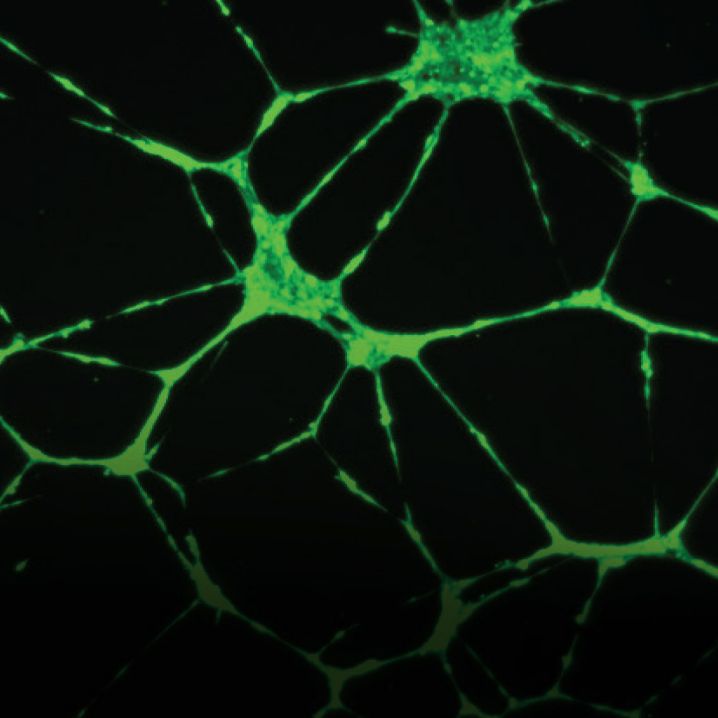 Corning® Matrigel® 基底膜マトリックス|細胞外基質 Corning Corning® Matrigel® 基底膜マトリックス|細胞外基質 Corning