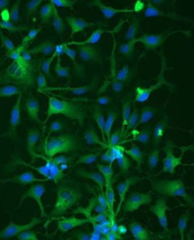 cls-webinar-choosing-right-cell-culture-surface-modified-surfaces-4b.jpg