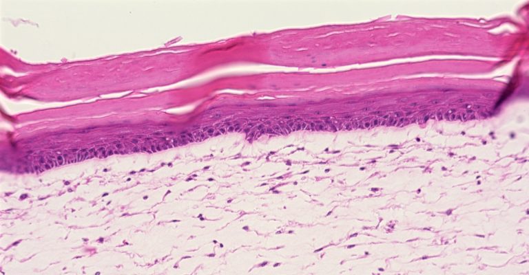 Generating Full Thickness Skin Models with Transwell Permeable Supports and the Corning Matribot Bioprinter