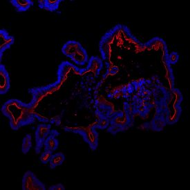 Blue and red organoid