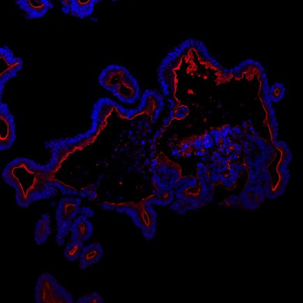 3D Cell Culture Models and Techniques | Drug Discovery and Advanced ...
