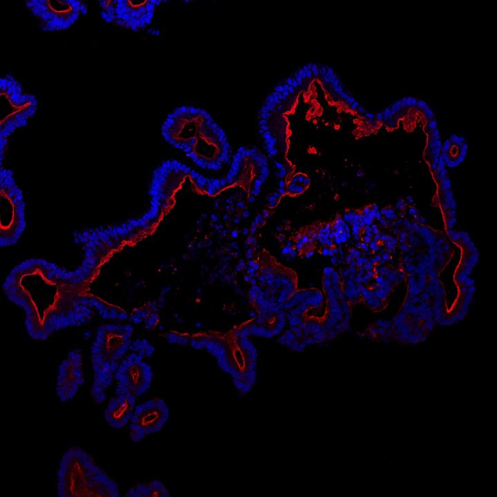 3D Cell Culture Models and Techniques | Drug Discovery and Advanced ...