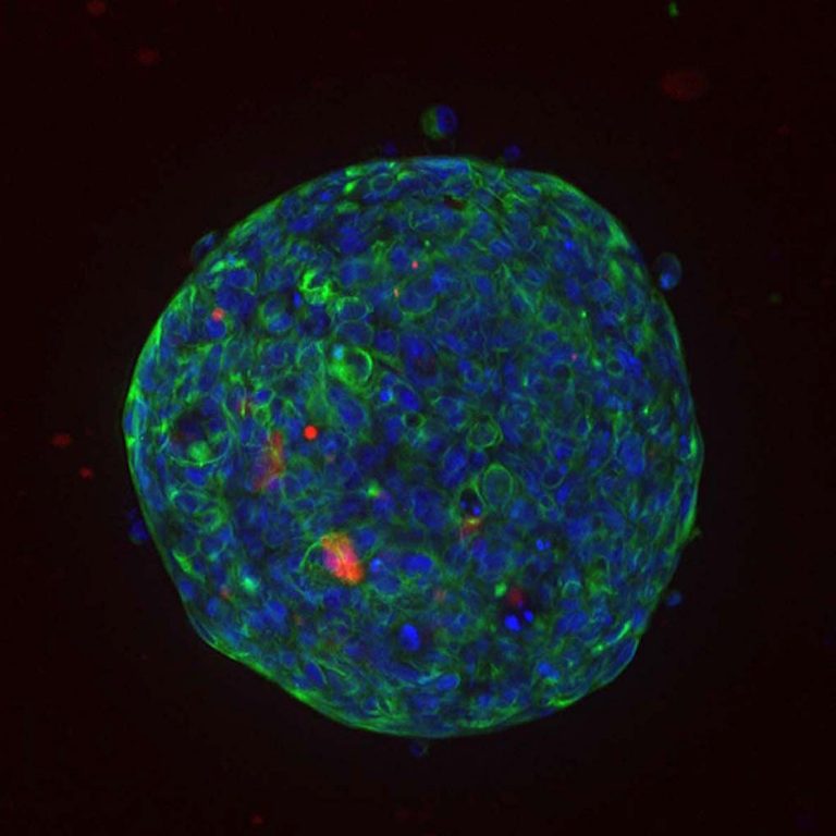 tumor microenvironment