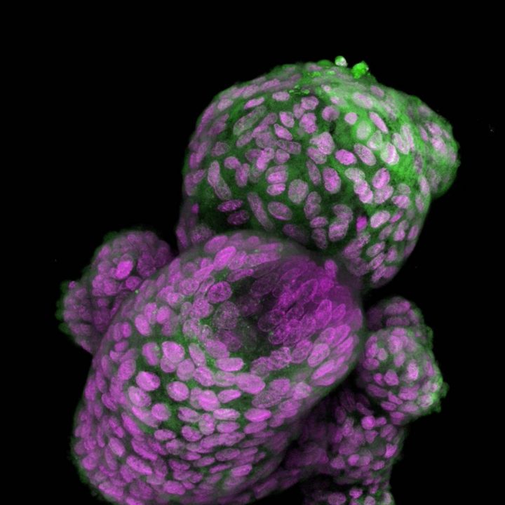 Organoids
