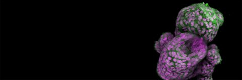 Spheroid vs. Organoid: What's the Difference?