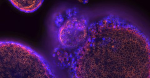 AI in Drug Discovery