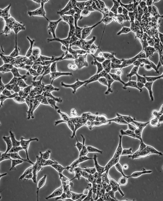 Corning® CellBIND® Surface Negatively Charged Advanced Tissue Culture Corning