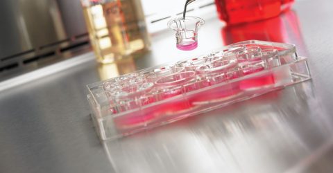 Request a Sample: Permeable Supports