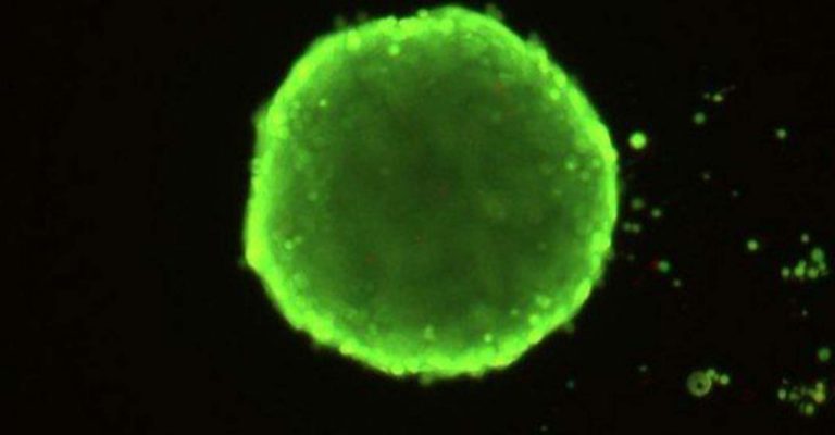 Green Spheroid 