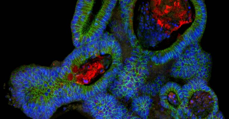 3D Model Systems: Spheroids, Organoids and Tissue Models