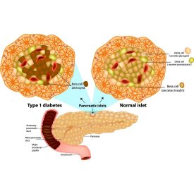 Diabetes Diagram