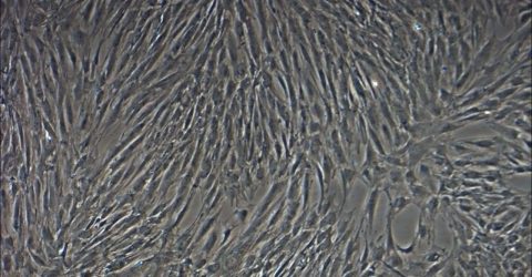 Overcoming Challenges of Rapid Stem Cell Expansion