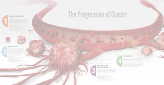The Progression of Cancer Poster | Corning | Request