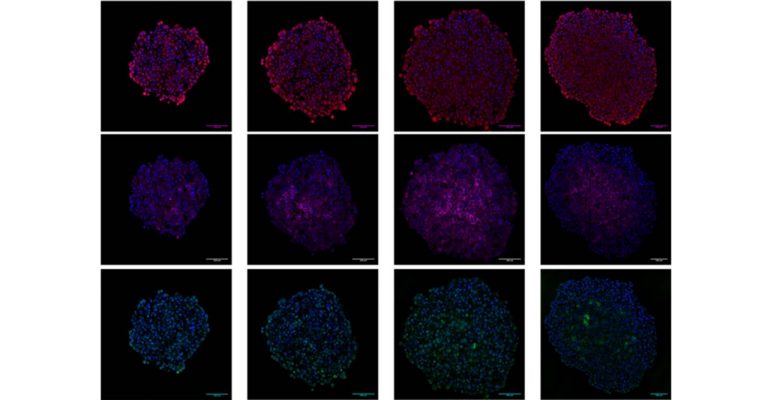 3D Models and Human Pancreatic Cancer