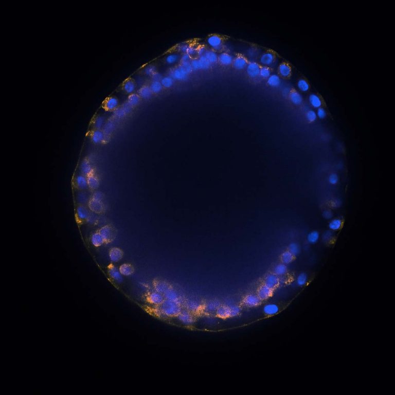 airway organoid