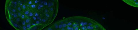 Lung Organoids