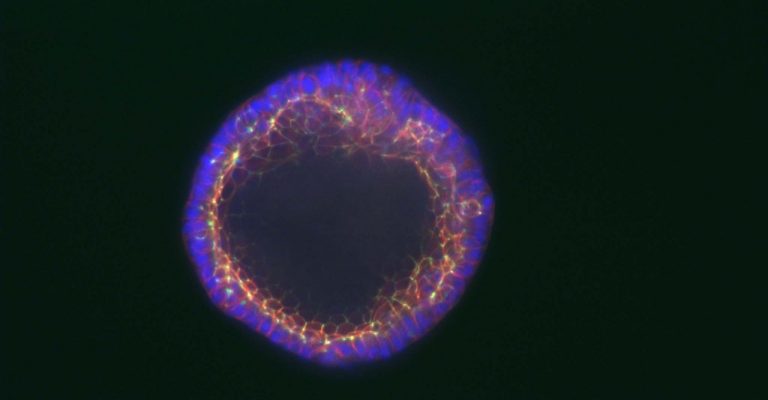 Lung Organoid