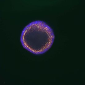 Lung Organoid