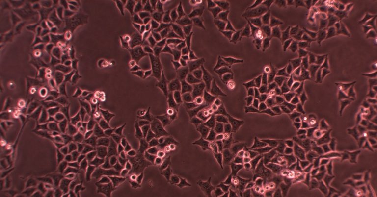 cls-nucleus-how-tocontrol-bacterial-contamination-ls.jpg