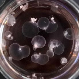 Polycystic kidney disease organoids cultured in Ultra-Low Attachment Plates, from Cruz et al. Nature Materials, 2017.