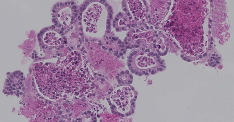 Purple organoid