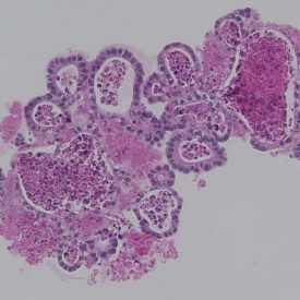 Purple Organoid